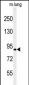 H6PD Antibody (C-term)